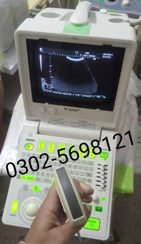 Aloka prosound6 ultrasound machine for sale