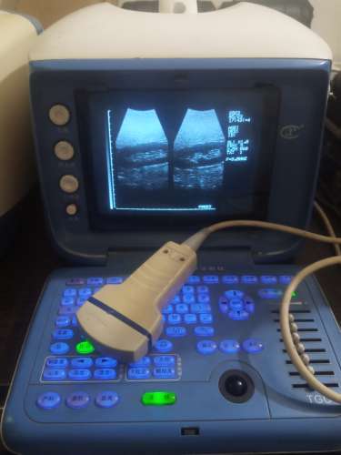 Used Portable ultrasound machine for sale