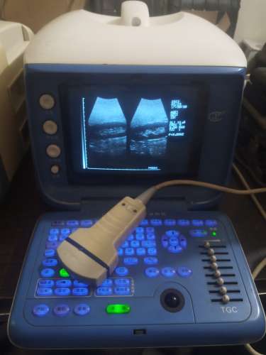 Used Portable ultrasound machine for sale
