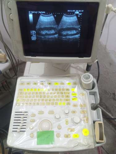 Aloka prosound6 ultrasound machine available