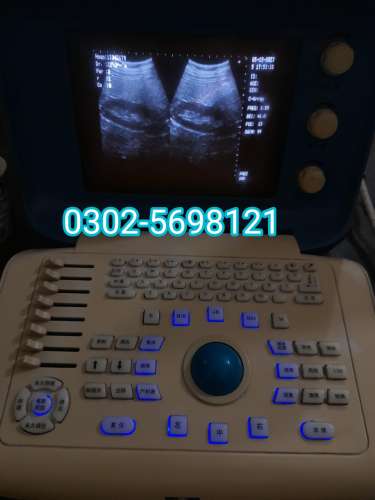 Forighn Use ultrasound machine for sale