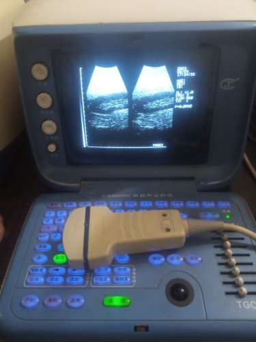 Forighn Use ultrasound machine for sale